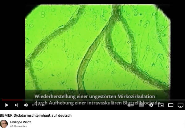 Bemer Video auf Youtube anschauen